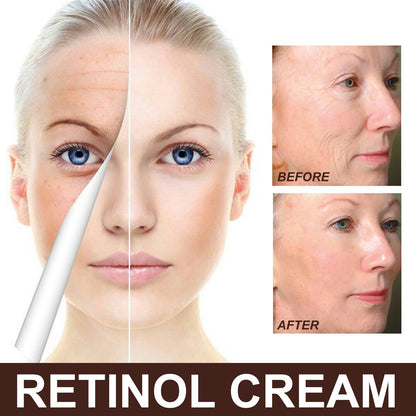 Retinol Anti Aging Cream