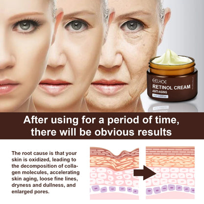 Retinol Anti Aging Cream